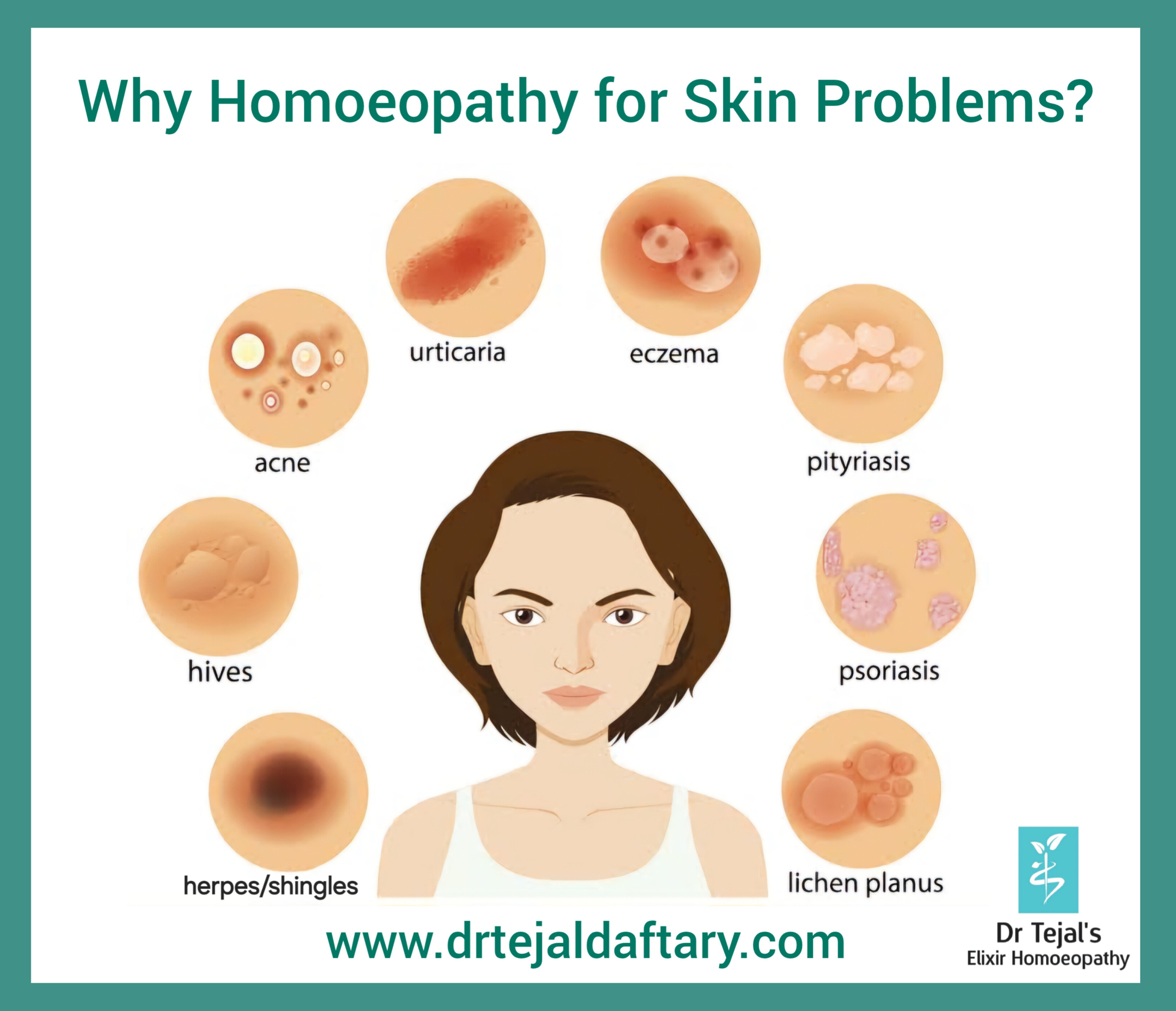 Why Homoeopathy for skin Problems ?